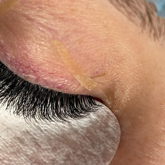 Лента для век